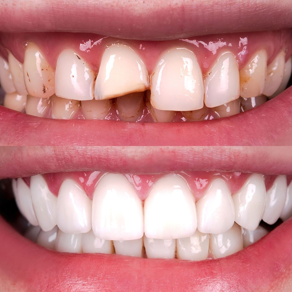 meilleur dentiste à agadir